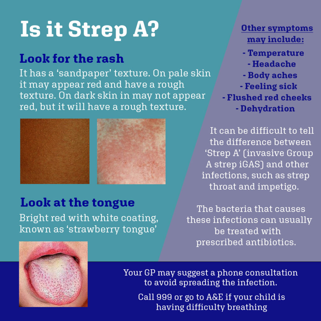 Group A Streptococcal Infections Can Cause Strep Throat Scarlet Fever 